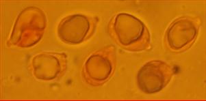 Sporen apfelkernförmig<br/>8,5 - 10,75 µm mal 5 - 6 µm