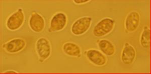 Sporen glatt<br/>5,25 - 6,25 µm mal 3 - 3,25 µm