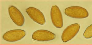 Sporen glatt mit Keimporus<br/>12 - 13,25 µm mal 6 - 7 µm