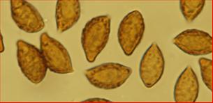 Sporen<br/>11,25 - 15 µm mal 7 - 8 µm