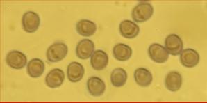 Sporen fast rund<br/>3,75 - 4,25 µm mal 3 - 3,25 µm