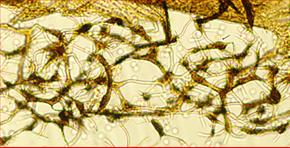 Maschenknoten spindelig mit ausgezogen Verbindungsfäden parallel