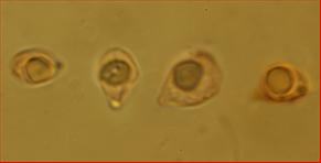 Sporen glatt  (etwas kollabiert)<br/>8 - 9 µm mal 5 - 5,5 µm
