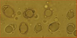 Sporen kurzelliptisch<br/>6,75 - 9 µm mal 4,5 - 6 µm