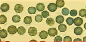 Sporen warzig, rund<br/>3,75 - 5 µm im Durchmesser