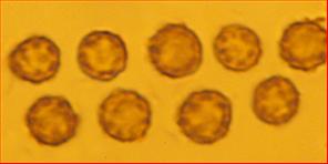 Sporen rund, vereinzelt warzig<br/>4,5 µm - 5 (5,5) µm