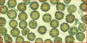 Sporen warzig, rund<br/>3,75 µm bis 5,25 µm im Durchmesser