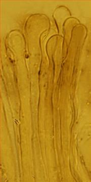 Paraphysen keulig<br/>4 - 6 µm breit