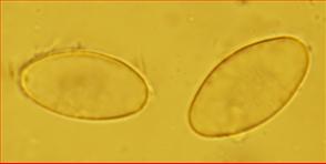Sporen glatt hyalin <br/>16 - 20 µm mal 8 - 11 µm