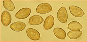 Sporen warzig<br/>11,25 - 12,25 µm mal 6,5 - 7,25