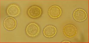 Sporen rund oder oval<br/>7 - 8 µm bzw.: 7 x 8,5 µm