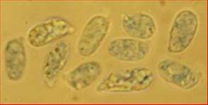 Sporen in Baumwollblau<br/>7,5 - 9 µm mal 4,75 - 4,25 µm