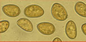 Sporen glatt breitelliptisch<br/>8,75 - 11 µm mal 5,5 - 7 µm