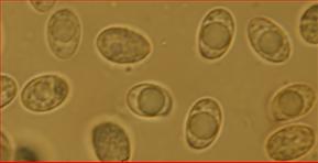 Sporen feinwarzig elliptisch<br/> 7 - 9 µm mal 4,5 - 5 µm