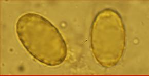 Sporen noch unreif, grobwarzig<br/>um 17 µm mal 11 µm