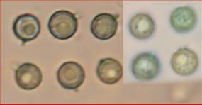 Sporen rund , mit Apiculus<br/>3,25 - 4,5 µm im Durchmesser