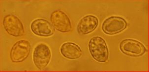 Sporen warzig breitelliptisch<br/>8 - 9,25 µm mal 5 - 6 µm