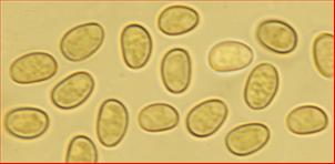 Sporen glatt<br/>5,5 - 6 µm mal 3,5 - 4 µm