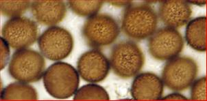 Sporen rund, feinstachelig<br/>9,5 - 11 (13,75) µm im Durchmesser