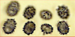 Sporen unregelmäßig stachelig<br/>6,75 - 9 µm mal 5 - 6,5 µm