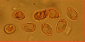 Sporen glatt elliptisch<br/>um 5 µm mal 4 µm