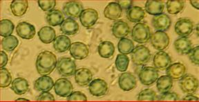 Sporen fast rund, schütter warzig<br/>4,25 - 5,25 µm mal 4,25 - 5 µm