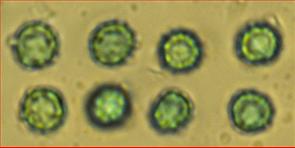 Sporen rund warzig<br/>3,75 - 5 (5,5) µm im Durchmesser