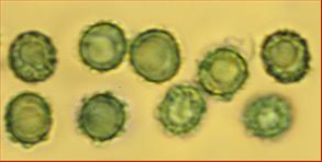 Sporen grob warzig, subglobos<br/>5,25 - 6,25 (7) µm mal (4) 5 - 5,75 µm